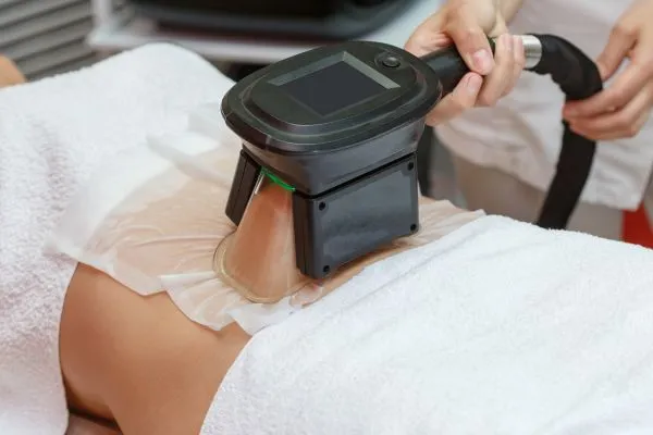 Image of person having fat freezing treatment to help weight gain Barrow